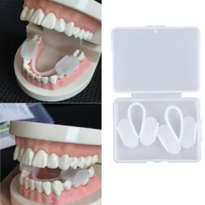 2pcs Dental Mouth Guard Bruxism Splint Teeth Grinding Sleep Aid Braces Too_ro - Picture 1 of 11
