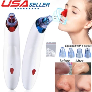 Electric Blackhead Remover Pore Vacuum Suction Facial Cleaning Tools Hot Sale - Picture 1 of 14