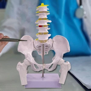 Female Pelvic Floor Model Pelvic Muscle Rehabilitation for Teaching Skeleton - Picture 1 of 5