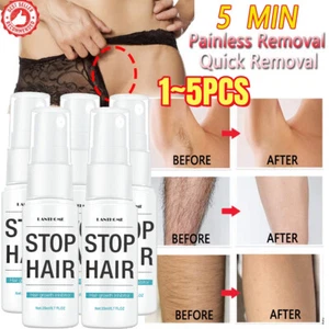 Permanent Stop Hair Growth Inhibitor Spray Painless Hair Removal for Men & Women - Picture 1 of 30
