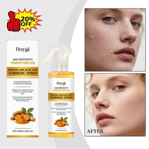 Spray Viso 100ML, Peeling Shot Esfoliante Acido Cogico Curcuma Spray - Foto 1 di 10