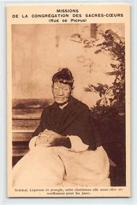 Hawaii - MOLOKAI - Leper colony - Leper and blind, this Christian woman also off - Picture 1 of 2