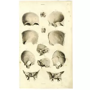 Hervorragende 1822 JOHN LIZARS handkolorierte Folio-Gravur: PL 7 KNOCHEN DES SCHÄDELS - Bild 1 von 8