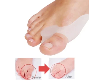 2 Stück Silikon Gel Daumenkorrektor Ballen Fuß Zehen Zehen Valgus Schutz Zehentrennung - Bild 1 von 8