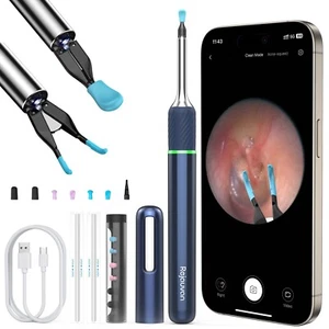 Ear Wax Removal Tool with Ear Camera, Ear Cleaner with Ear Pick &Tweezers Mod... - Picture 1 of 7