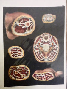 1850 ANATOMIE Dissection cou épaule bras coude main coupe transversale - Imagen 1 de 3