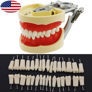 Dental Typodont Model NISSIN 200 Restorative Practice 32 Pcs Teeth Mount Pole - Picture 1 of 33