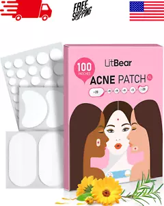 Large Acne Pimple Patches, 100 Count, 6 Sizes for Face, Chin, or Body - Picture 1 of 10