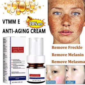 Crema blanqueadora eficaz para eliminar manchas oscuras crema para eliminar melanina melasma - Imagen 1 de 13