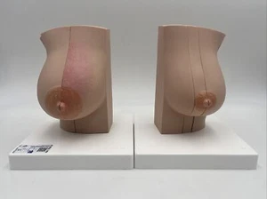 3B Scientific L56 Modell der weiblichen Brust mit gesundem & ungesundem Gewebe - Bild 1 von 9