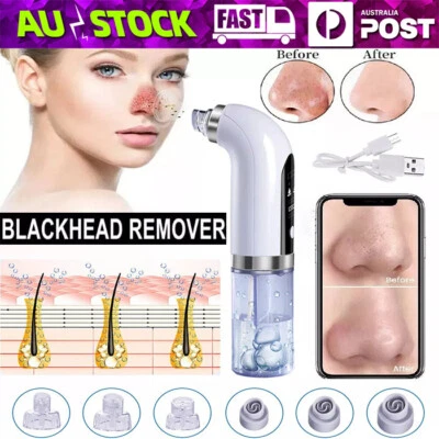 Vacuum Blackhead Remover Facial Skin Pore Acne Pimple Suction Cleaner Machine OZ - image 1 of 4
