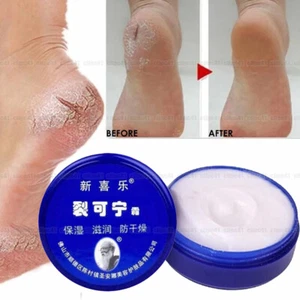 Anti-Drying Foot Cream Heel Cracked Repair Removal Dead Skin Care Ointment 33g - Picture 1 of 12