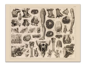 Anatomy SKELETON MUSCLES TENDONS MOUTH THROAT Vintage Illustration - Art Print - Picture 1 of 3