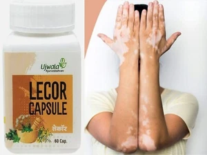 Ujwala Ayurvedashram Lecor Capsula (60 Cap) I Medicina Ayurvedica per Vitiligine - Foto 1 di 4