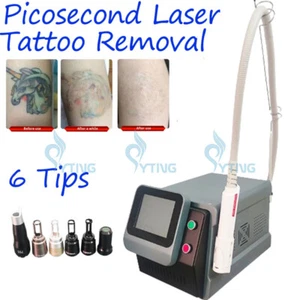 non-invasive laser tattoo removal machine ND yag picosecond caron facial peel - Picture 1 of 8