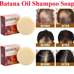 Batana Oil Shampoo Bar for Damaged, Thinning Hair, Cleaning & Nourishing Hair - Picture 1 of 17
