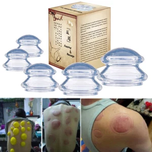 5 Cups Cupping Therapy Set Silicone Suction Massage Pain Relief For Face Body - Picture 1 of 9