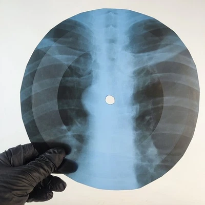 PINK FLOYD SUMMER 68 X-Ray USSR Record Roentgen Bone Ribs Music Vinyl - image 1 of 2