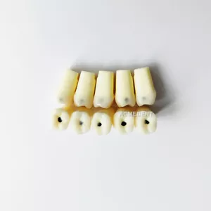 Dental Molar Vitro Teeth Decay Caries Tooth Model Dentist Student Practise Test - Picture 1 of 11