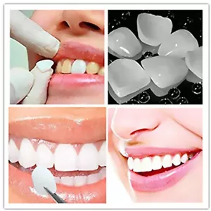 Faccette sbiancanti dentali ultrasottili denti in resina tonalità anteriore superiore inferiore - Foto 1 di 20