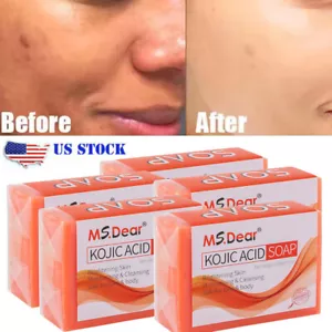 Kojic Acid Soap Dark Skin Whitening Bleaching Lightening Brightening Face & Body - Picture 1 of 19