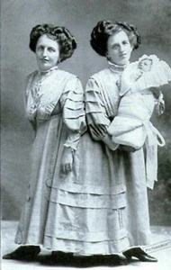 Diapositiva fotográfica vintage. Gemelos siameses Rosa y Josefa Blazek - Imagen 1 de 5