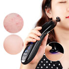 Plasma Acne Pen Skin Rejuvenation Plasma Scar Freckle Removal Beauty Machine