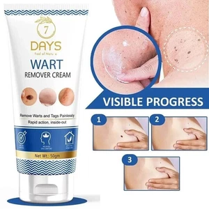 7 Tage Warzenentferner Creme für Männer & Frauen, Hilft, Warzen zu beseitigen 50g. - Bild 1 von 7