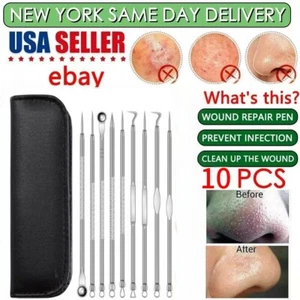 Acne Needle Pimple Popper Blackhead Remover Kit Tools Comedone Zit Extractor - Picture 1 of 14