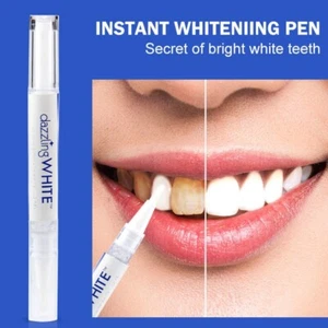 BOLIGRAFO blanqueador dientes, blanqueamiento dientes, dientes blancos - Foto 1 di 4