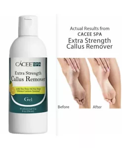 Callus Remover Foot Tea Tree Oil Lemon Feet Gel Extra Strength Formula Pedicure - Picture 1 of 12