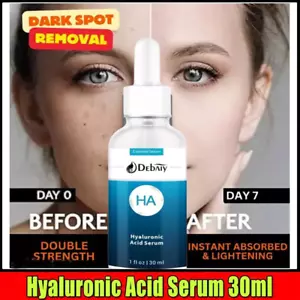 Hyaluronic Acid Skin Care Rapid Reduction Serum Bags & Wrinkles 30ml - Picture 1 of 9
