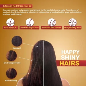 ThriveCo Onion Hair Oil 200ml - Pack of 1 | Jojoba, Hibiscus | Growth & Shine - Picture 1 of 8