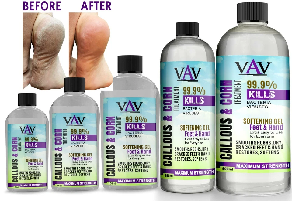Callus & Maisentferner Flüssigkeit - Behandlung für Fuß & Hand, schmerzfreies Entfernungsöl - Bild 1 von 1