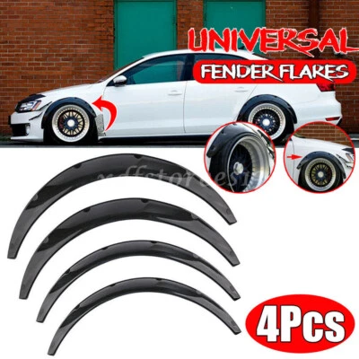 Universal For Car Fender Flares Flexible Carbon Fiber Color Fenders Polyurethane - Image 1 of 4