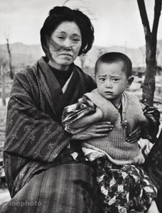 1946/66 Vintage ALFRED EISENSTAEDT Hiroshima Nuclear Bomb Survivors WWII Japan - Picture 1 of 1