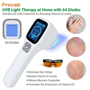 Phototherapy Treatment Device 308nm Uva Light Therapy for Skin White Spots - Picture 1 of 11