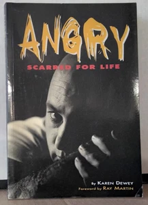 ANGRY SCARED FOR LIFE by KAREN DEWEY 1994 Angry Anderson ROSE TATTOO bio BOOK - Picture 1 of 4