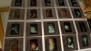 14 Vol. Set Objektträger Atlas der Infektionskrankheiten, Gower Medical, 1000+ 35mm Objektträger - Bild 1 von 11