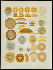 1879 - Plank Medicine Amoeba - Arcella Vulgaris/Angulosa/Discoides - Leidy