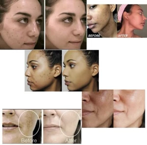 One 30gr Dark Spots Cream - Picture 1 of 2
