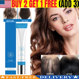 Hair Scalphy 20ml Seapuri Scalphy Hair Keep Scalp Clean Non Greasy Scalp Hair~~ - Picture 1 of 9