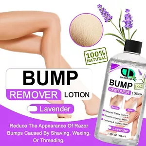 Bump Remover Lotion | Reduces Razor Bumps & Prevents Ingrown Hairs For All Skin - Picture 1 of 9
