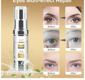 NEW Anti Aging Eye Cream for Dark Circles and Puffiness that Reduces Eye Bags$36 - Picture 1 of 7
