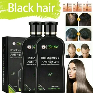 Shampoo per Donna Uomo Crescita Rapida Capelli Trattamento Anti Perdita Capelli Ispessimento Capelli. - Foto 1 di 8