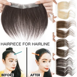 Lace/PU Women Cover Up Remy Human Hair Topper Receding Hairline Pieces Patches - Picture 1 of 20