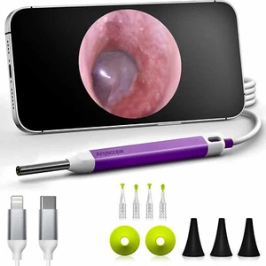 1 MP, USB-C Digital Otoscope Type-C, Phone & Tablet Ultra Clear View Ear Camera - Picture 1 of 6
