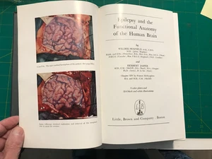 Epilepsie & funktionelle Anatomie des menschlichen Gehirns - Bild 1 von 13