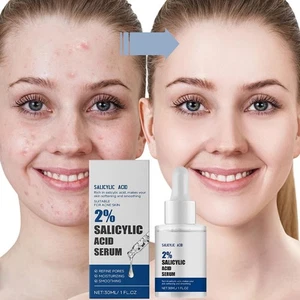 2%SALICYLIC ACID SERUM Facial serum,quickly relieves acne, Gentle non-irritating - Picture 1 of 11