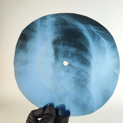 LED ZEPPELIN DAZED &CONFUSED X-Ray USSR Record Roentgen Bone Ribs Music Vinyl - Image 1 of 2